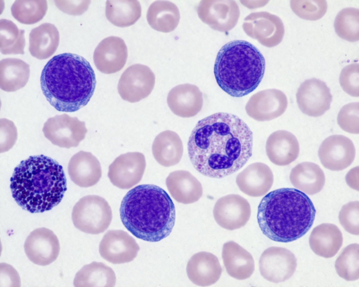 Realistic Giemsa-Stained Blood Smear — AI Prompt